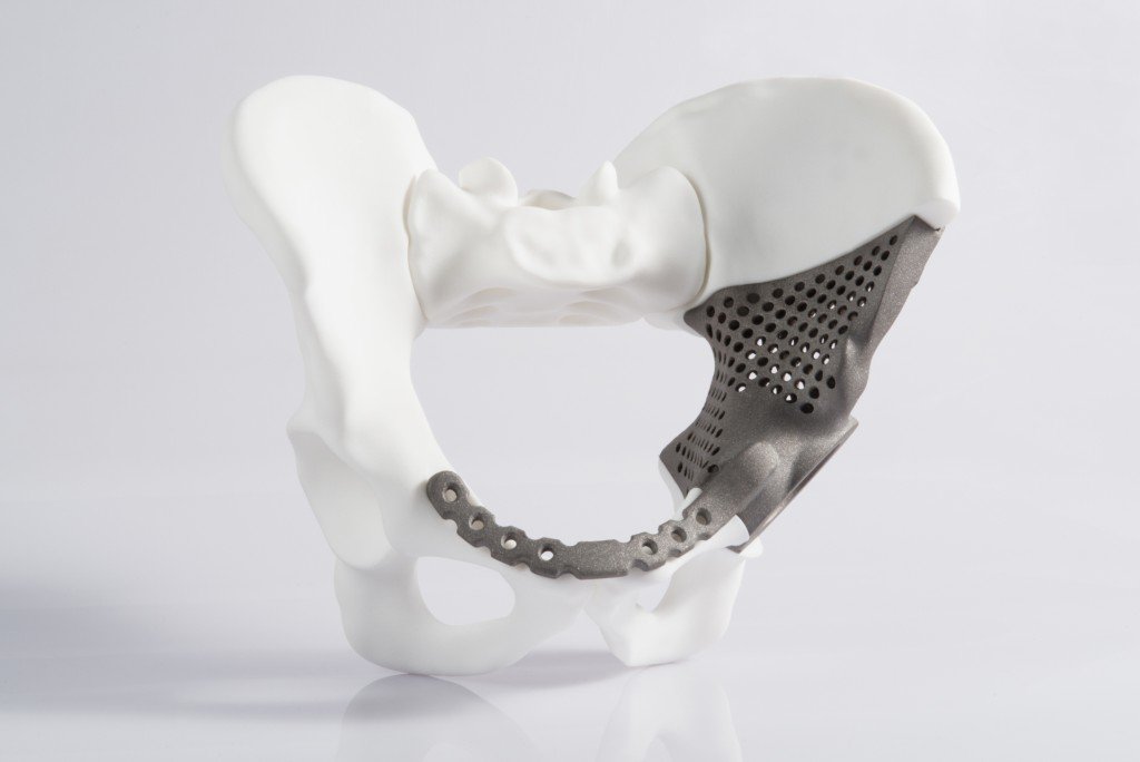 FDA & Metal 3D Printing for Medical Devices: Where Compliance Meets Innovation